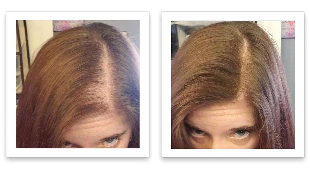 Caboki All-Natural Hair Building Fiber. Make Thin Hair Look 10X Fuller Instantly. Eliminate the