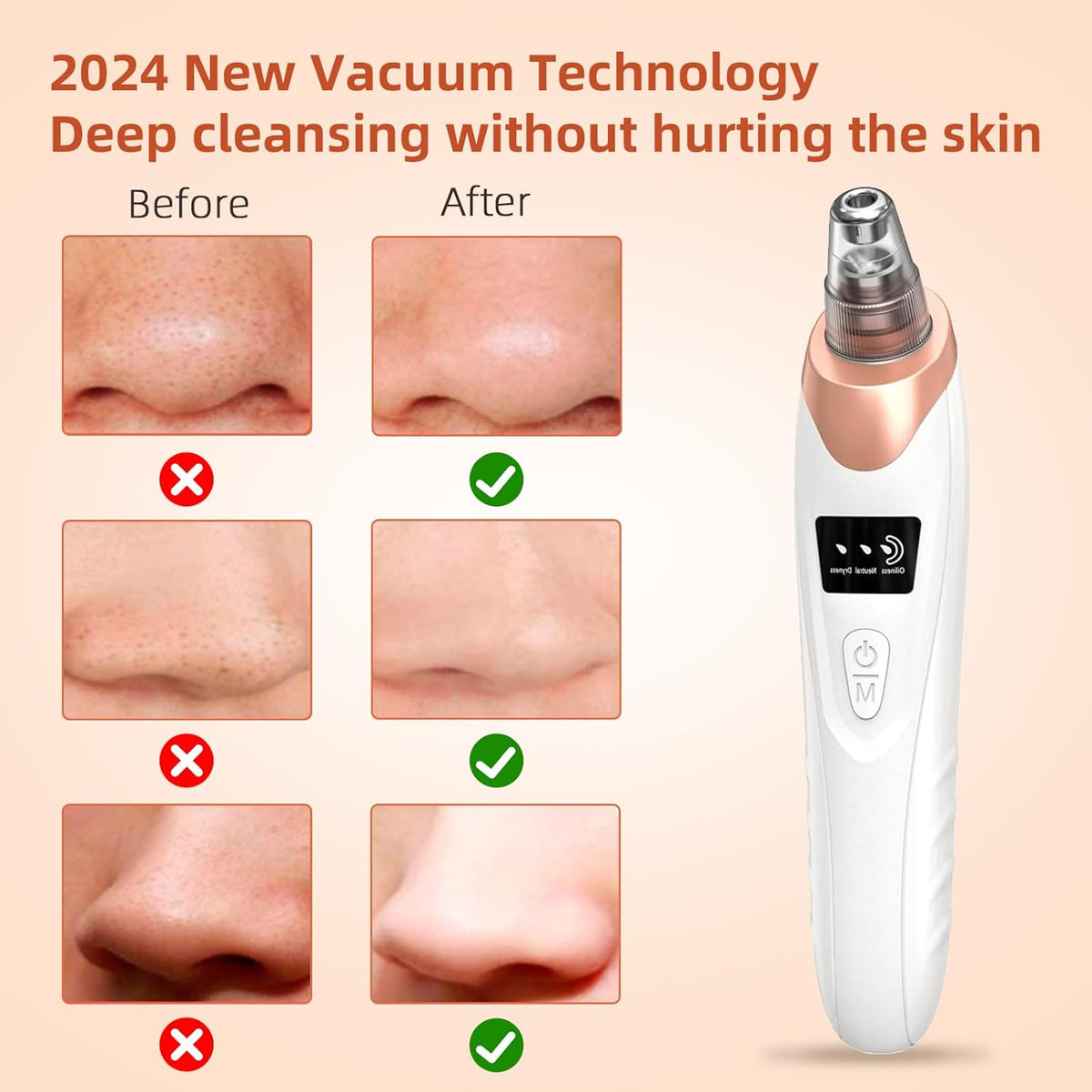 2025 Pore Vacuum, USB Rechargeable Blackhead Remover Vacuum,3 Levels Adjustable Pore Vacuum