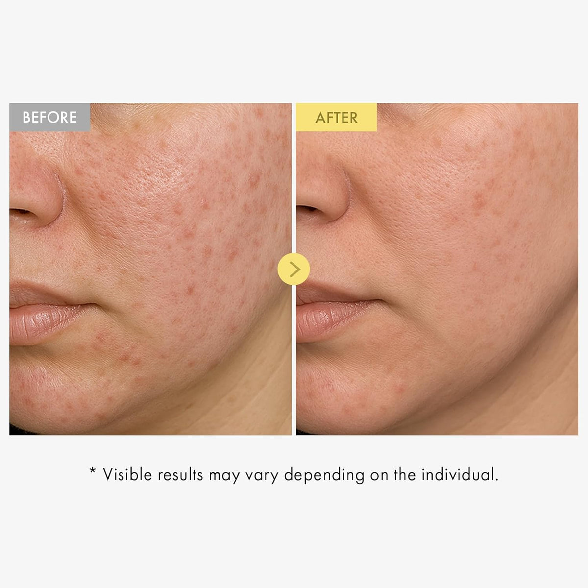 Honey Glow 65% Propolis Serum, Hyaluronic Acid, Kojic Acid, Niacinamide, Hydrating Facial Soothing