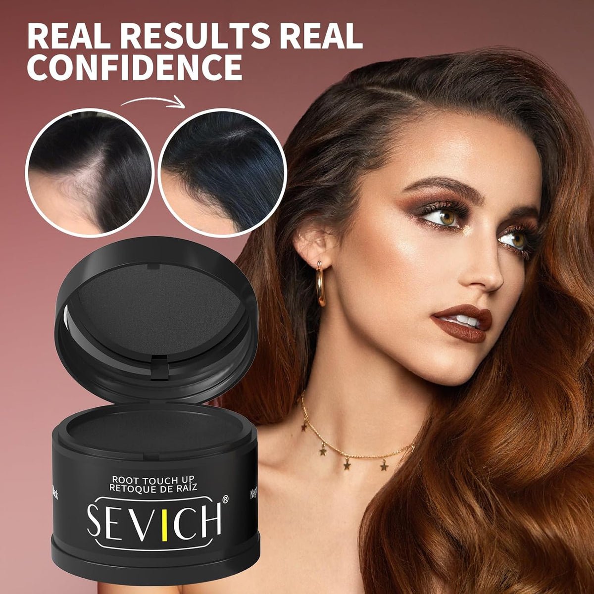 Sevich Hairline Powder, Instantly Conceals Hair Loss, Hair Shadow Toppers for Women & Men, Root