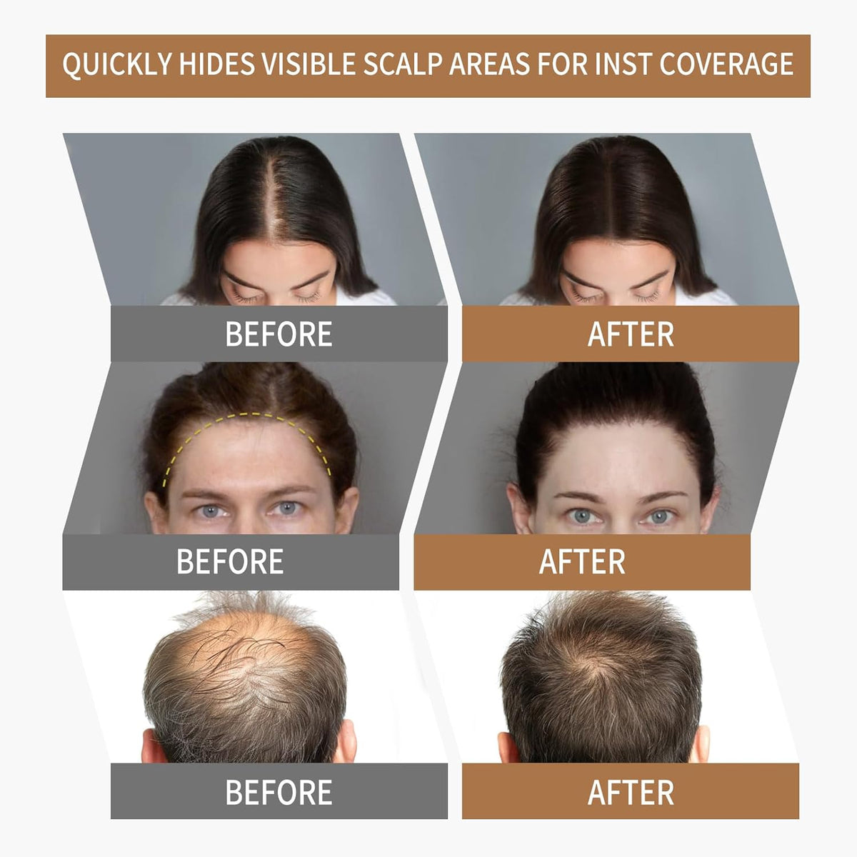 Sevich Hairline Powder 2.0，Instantly Conceals Hair Loss, Root Touch up Powder, Hair Shadow Toppers