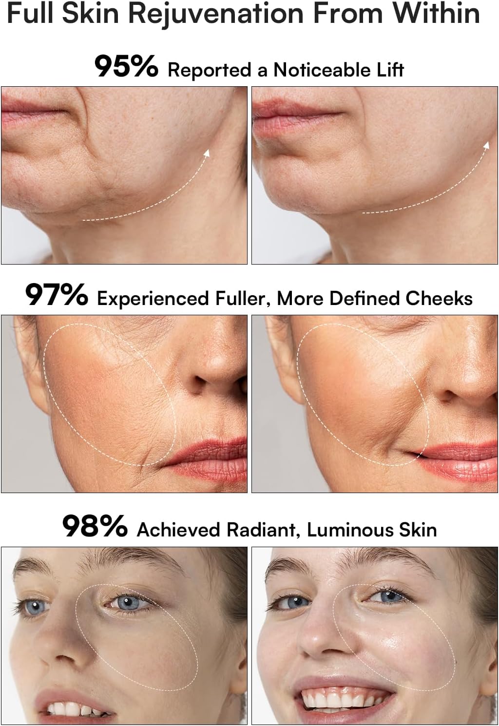 INIA 3-in-1 Red Light Therapy for Face and Neck Beauty Device for Puffiness & Skin Firming Skincare