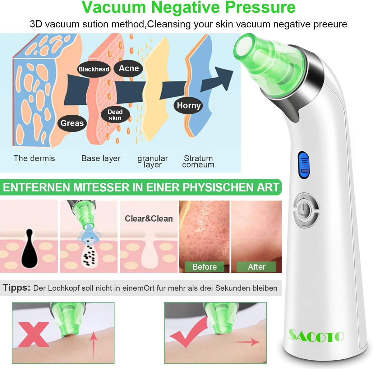 Blackhead Remover Pore Vacuum, Face Suction Pore Cleanser, 5 Suction Power Electric Blackhead