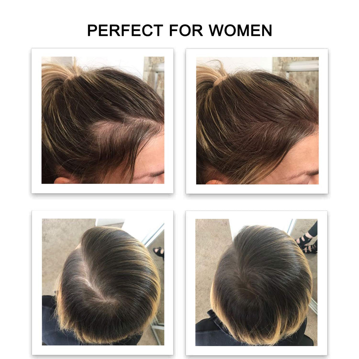 FEBRON Hair Fibers For Thinning Hair LIGHT BROWN Giant 30G For Women & Men Hair Loss Concealer Hair
