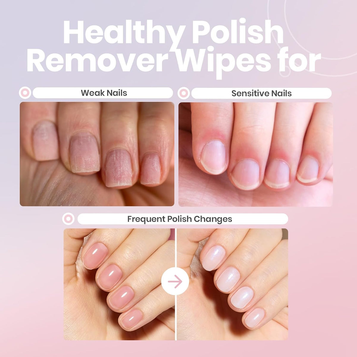 Beetles Non Acetone Nail Polish Remover - 0.67Fl Oz/20ML Controllable Nourishing Formula Acetone