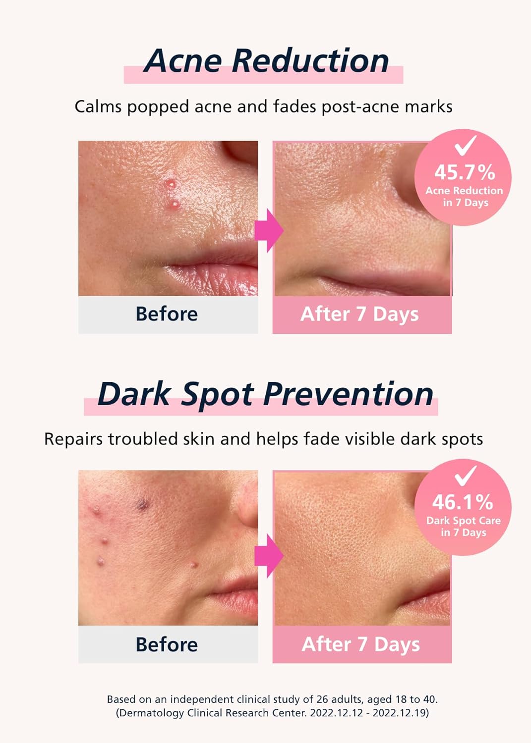 EasyDerm Real Calming Microdart Pimple Patches, Clear Micropoint | Niacinamide, Hyaluronic Acid