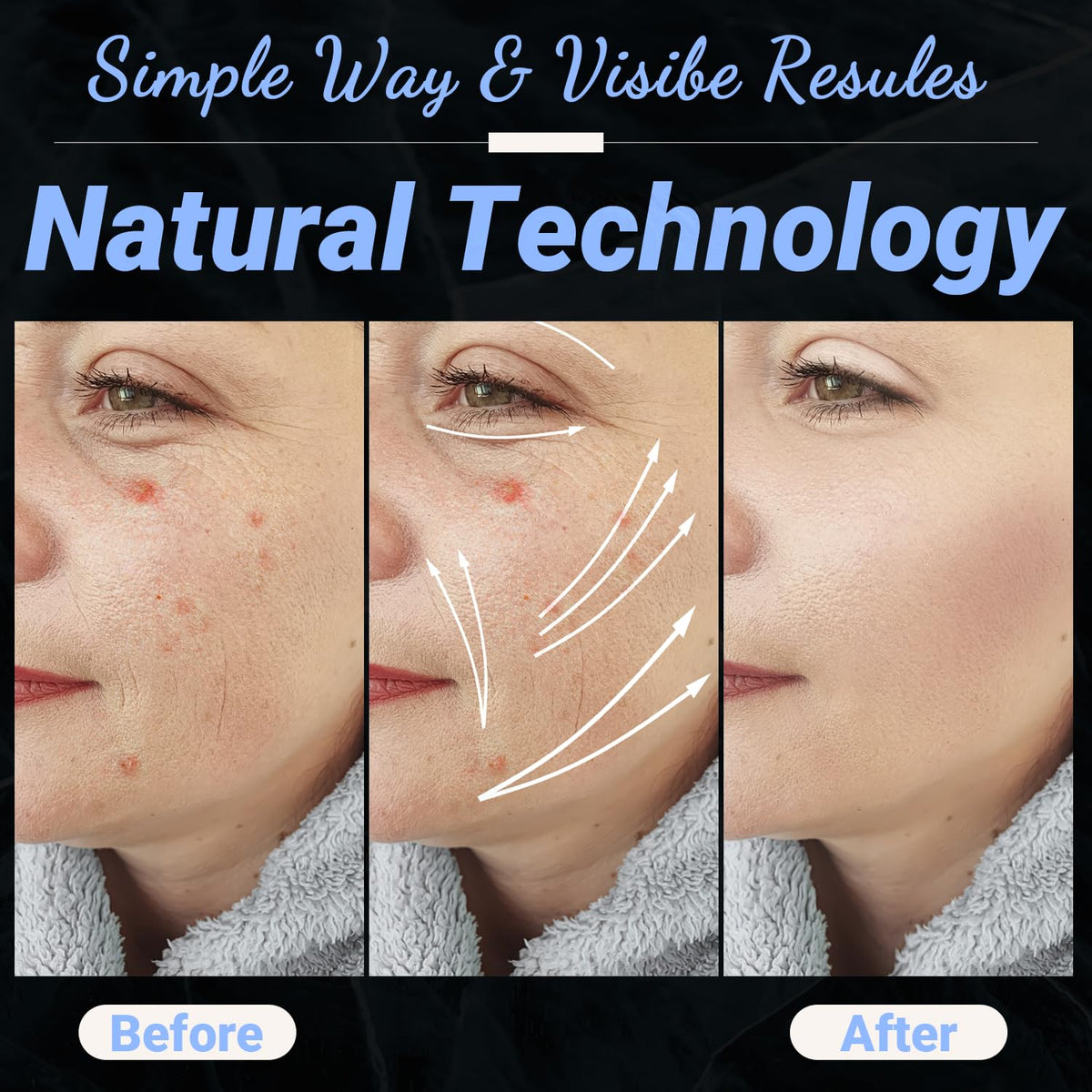 High Frequency Facial Wand - UUPAS Portable Handheld 4 in 1 Blue High Frequency Skin Facial Machine