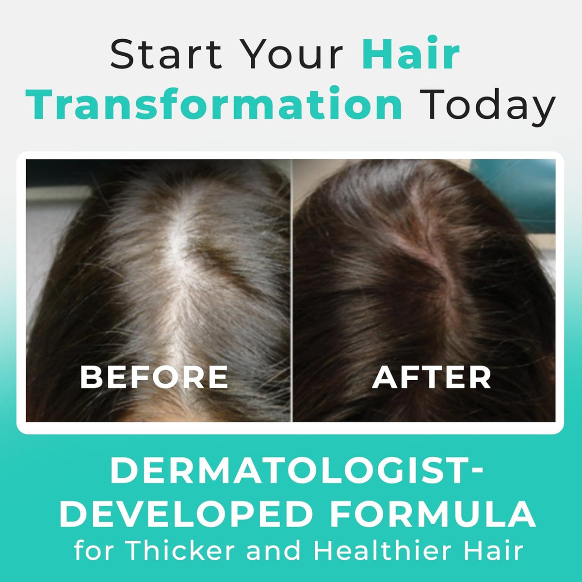 Hair Plus MD Hair Growth Supplement, 120 Capsules – Supports Hair Growth & Density