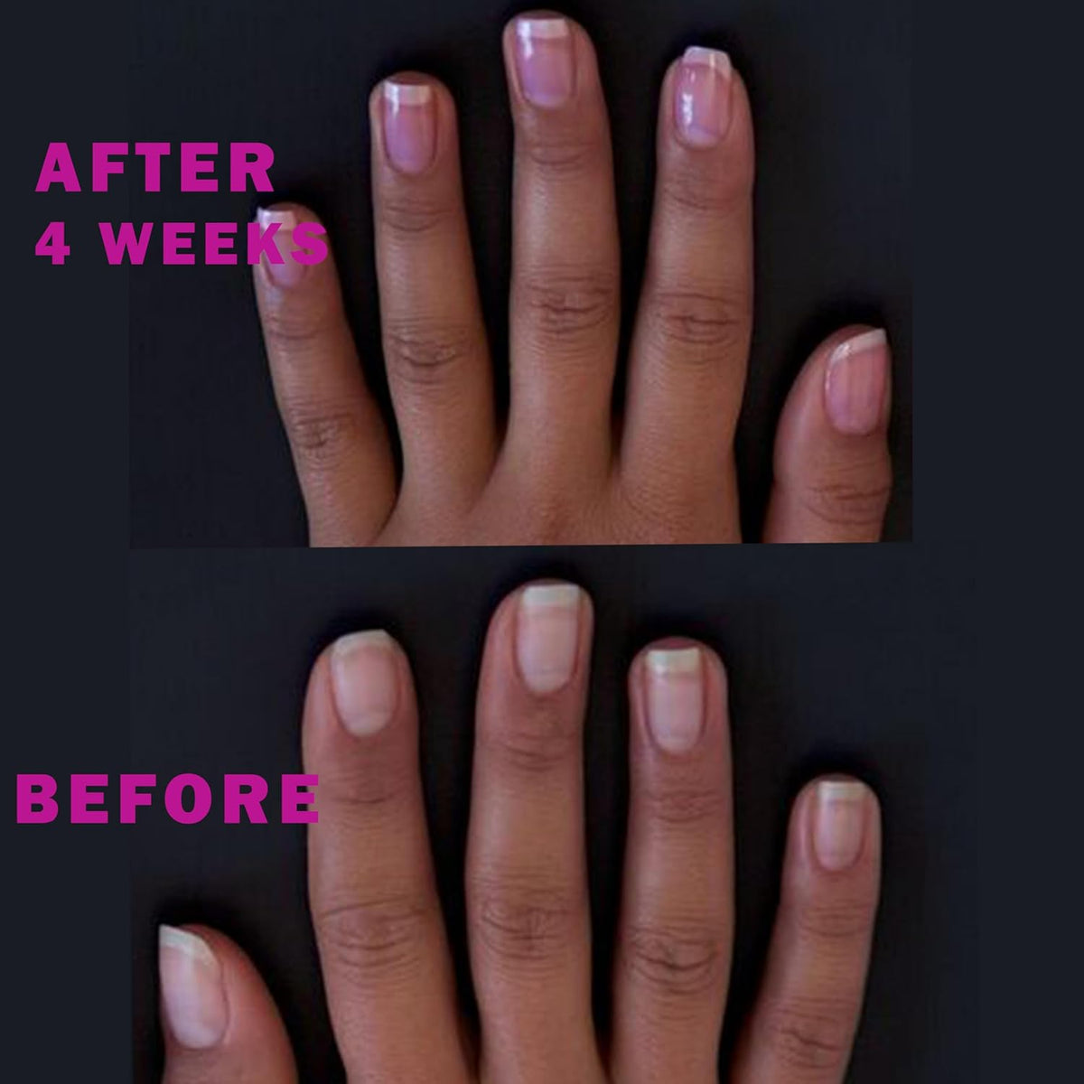 Perfect Formula Ruby Pink Gel Coat - Nail Strengthener, Keratin Nail Treatment, Gemstone Pink Gel