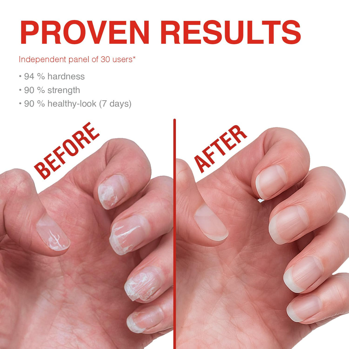 Probelle Nail Strengthener and growth, Natural Nail Strengthening Clear Nail Polish Repair