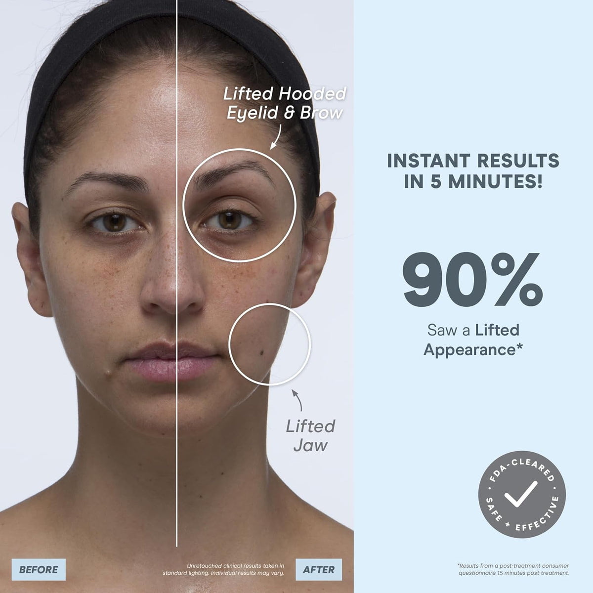 NuFACE MINI+ Microcurrent Facial Device Kit - FDA Cleared Face Sculpting & Skin Tightening Device