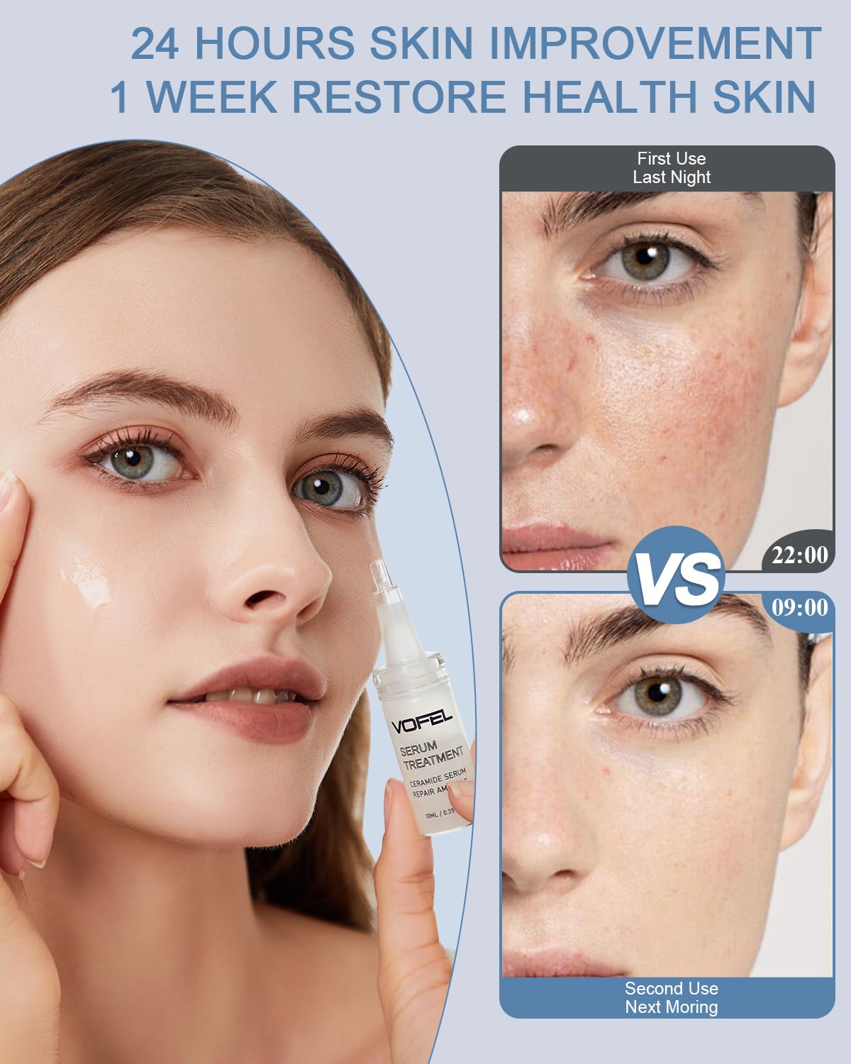 Ceramide Serum for Skin Barrier Repair, Hydrating Serum to Reduce Dryness and Wrinkles, 5% Ceramide