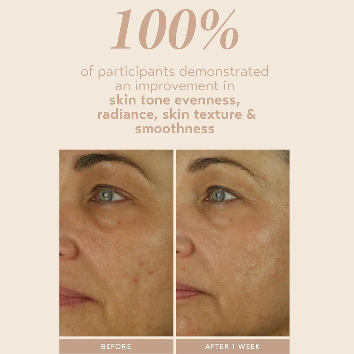 SHANI DARDEN SKIN CARE Retinol Reform with 1% Encapsulated Retinol Serum for Face & Neck, Gentle