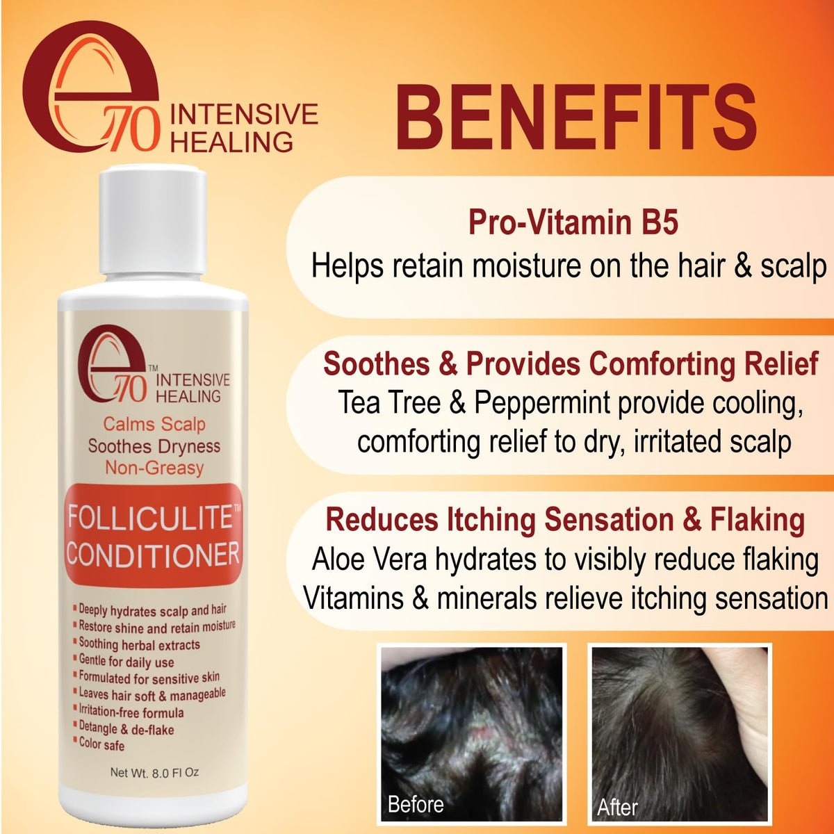 Folliculitis Treatment Conditioner with 3% BHA, Salicylic Acid, Tea Tree Oil & Chamomile Extracts