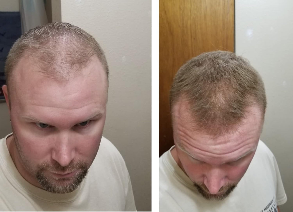Caboki Hair Loss Concealer. Makes Thin Hair Look 10X Fuller Instantly. Eliminates Bald Spot and