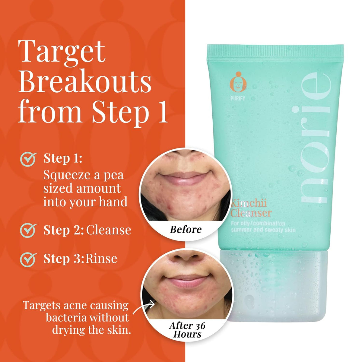 Norie Kimchii Face Wash - Gentle Facial Cleanser for Dry, Oily & Sensitive Skin | Fragrance Free