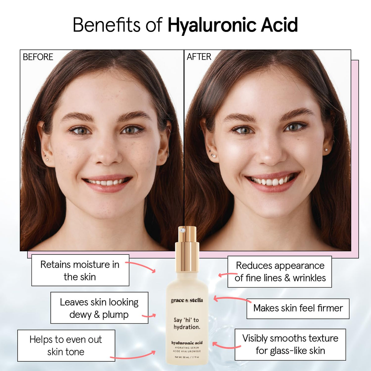 grace & stella Award Winning Hyaluronic Acid Serum (30ml/1 fl oz) Hydrating Hyaluronic Acid Serum