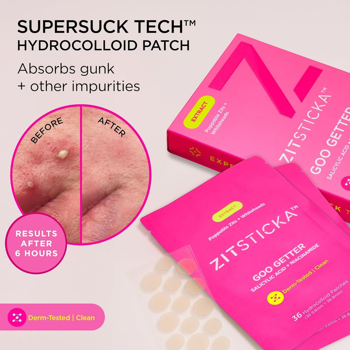 ZitSticka Pimple Patches for Face and Body, Hydrocolloid Patches to Cover Zits, Acne Patches or Zit
