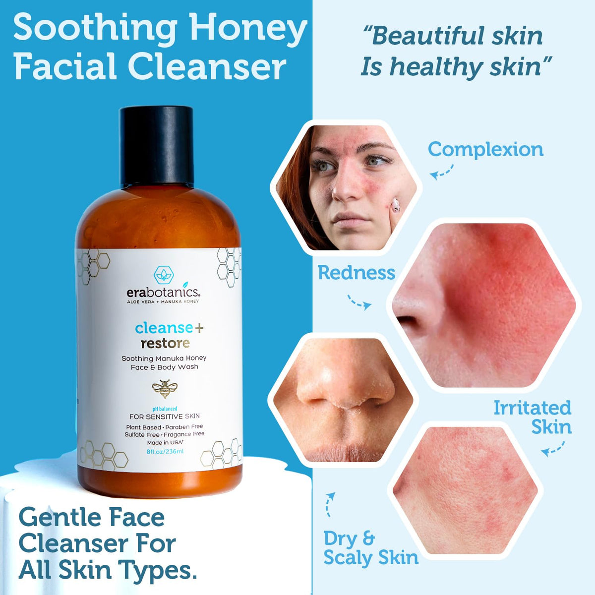 Manuka Honey Face Wash for Women and Men - Sulfate Free Moisturizing Cleanser with Organic Aloe