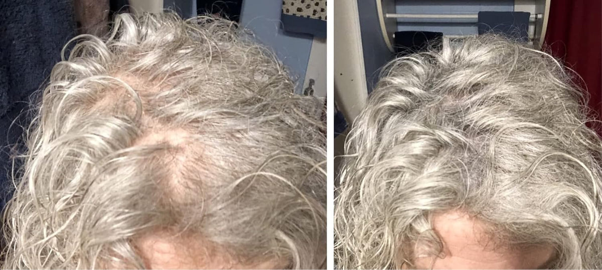 Caboki Hair Loss Concealer. All-Natural Hair Building Fiber. Make Thin Hair Look 10X Fuller