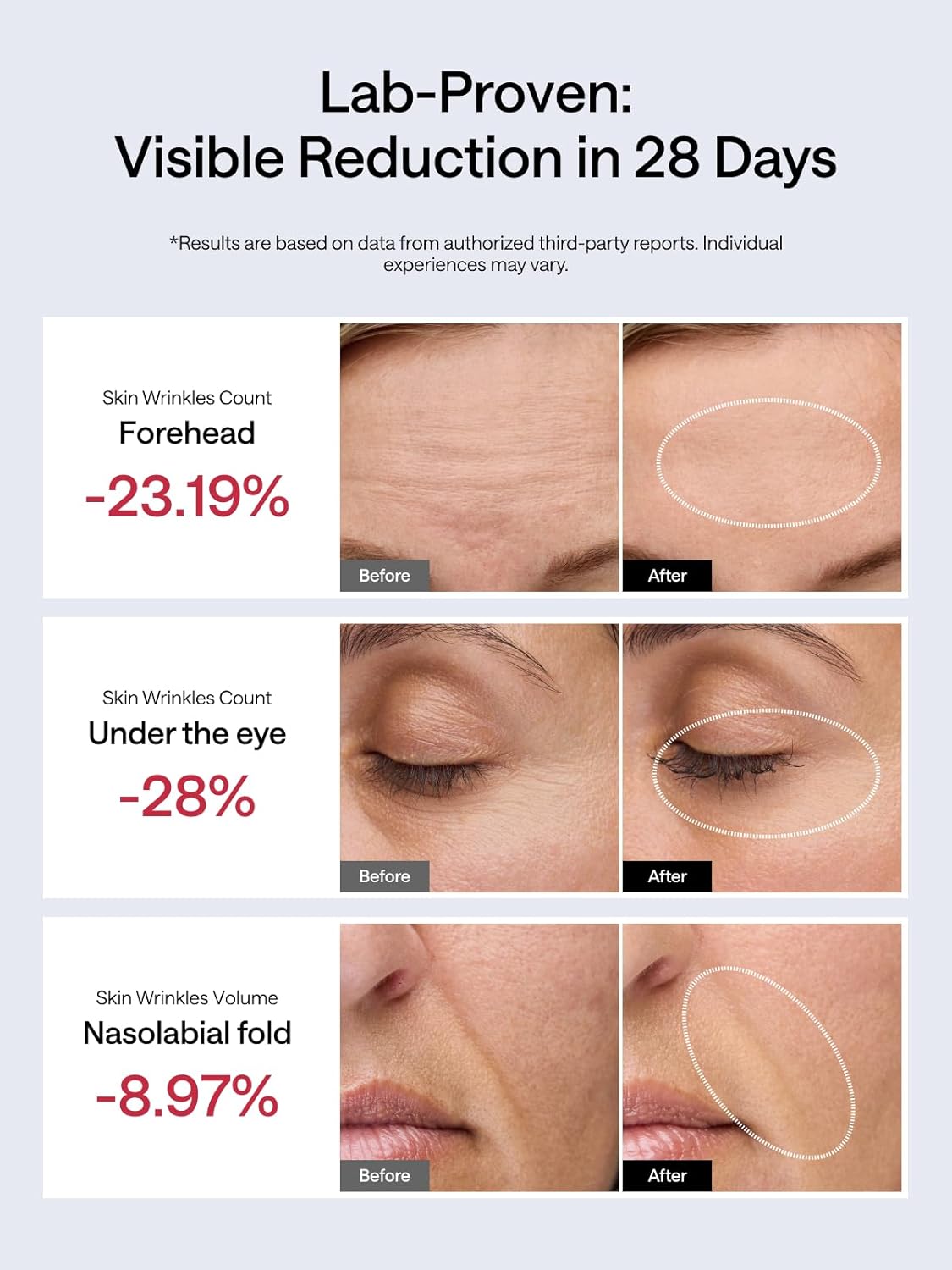 JMOON NouvelleSkin Facial Toning Device, FDA-Cleared Microcurrent Facial Device and Red Light