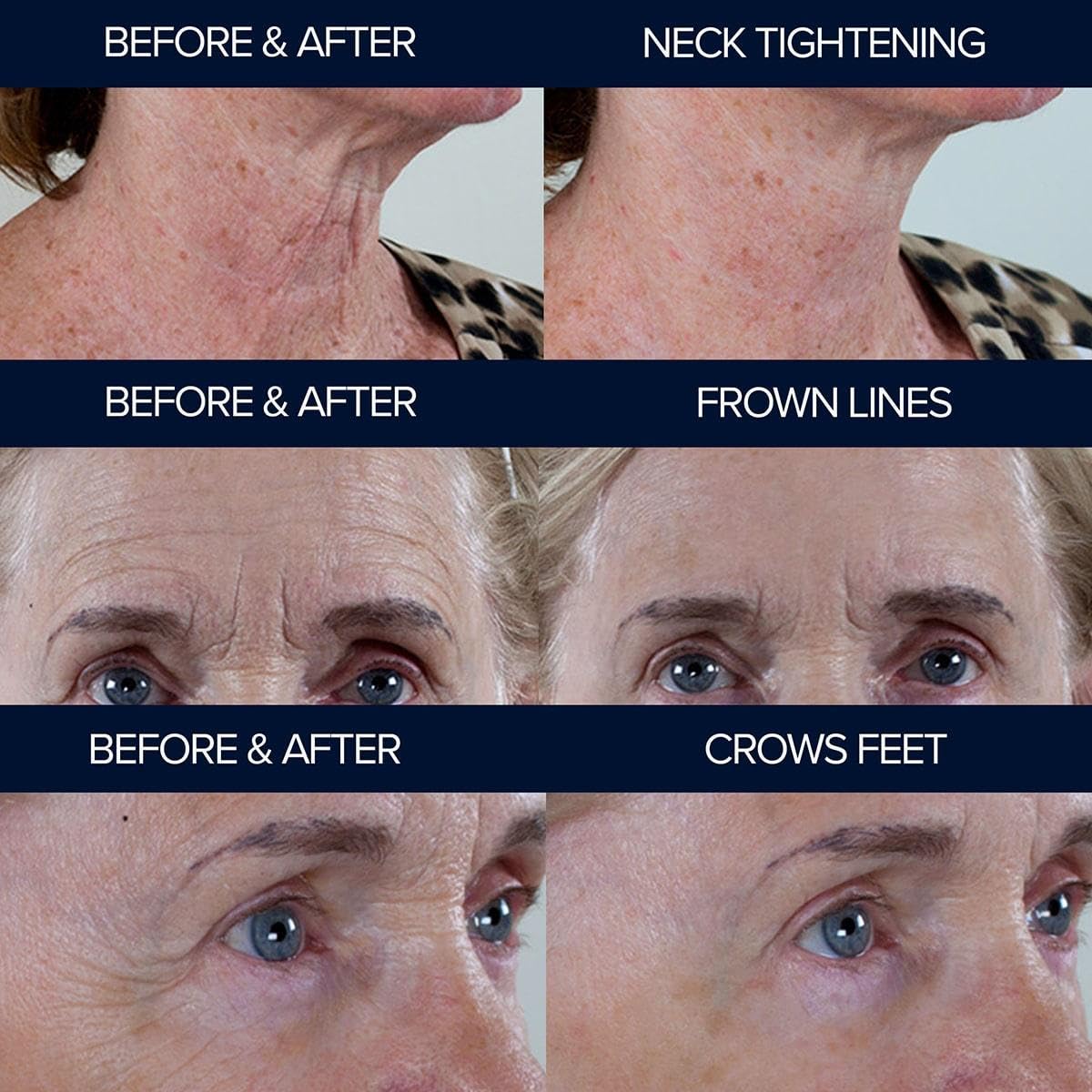 Peptide10 – Anti-Aging Peptide Serum – Firms, Smooths & Reduces Wrinkles – With Multi-Peptide