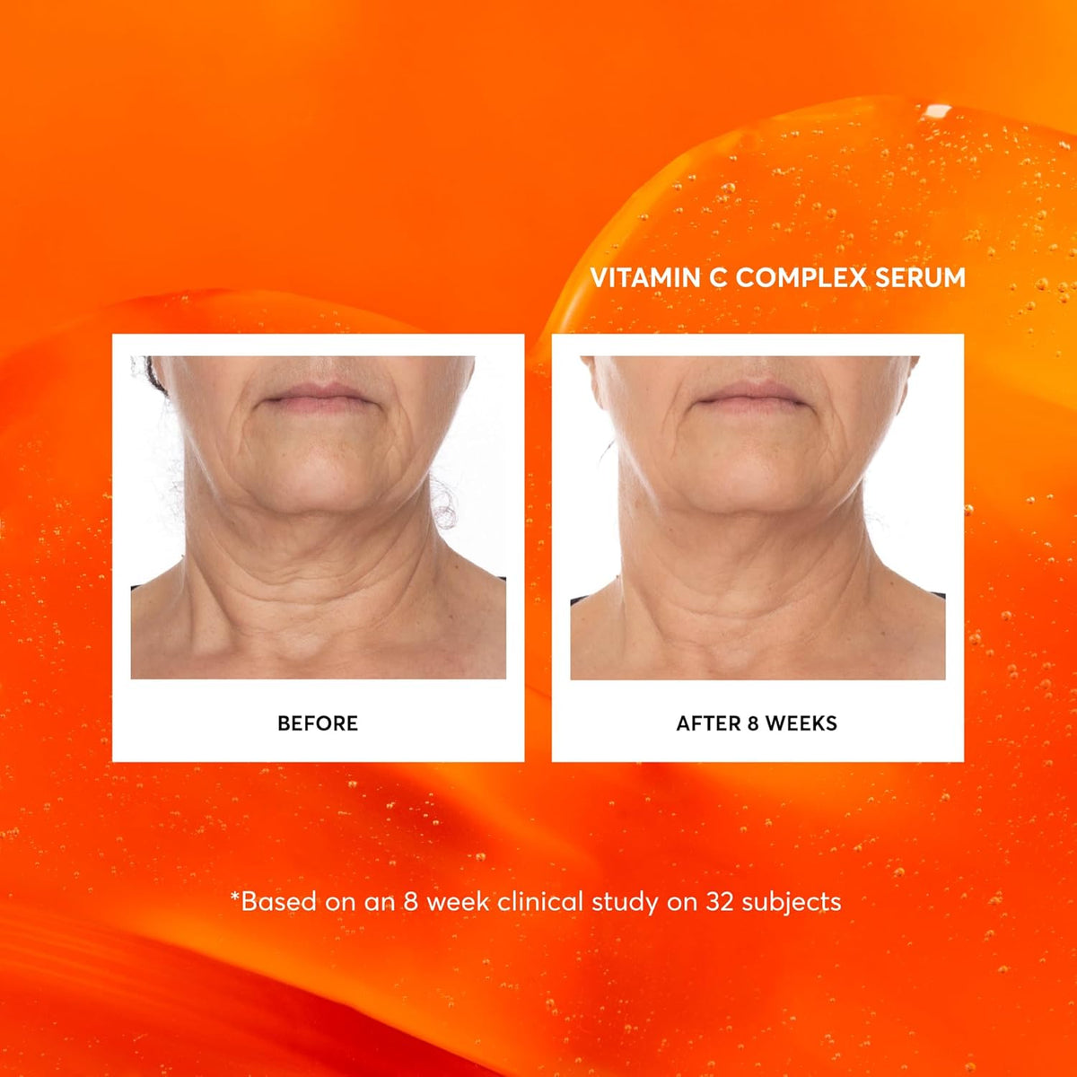 Naturium Vitamin C Complex Face Serum, Anti-Aging Facial Treatment with Hyaluronic Acid & Vitamin