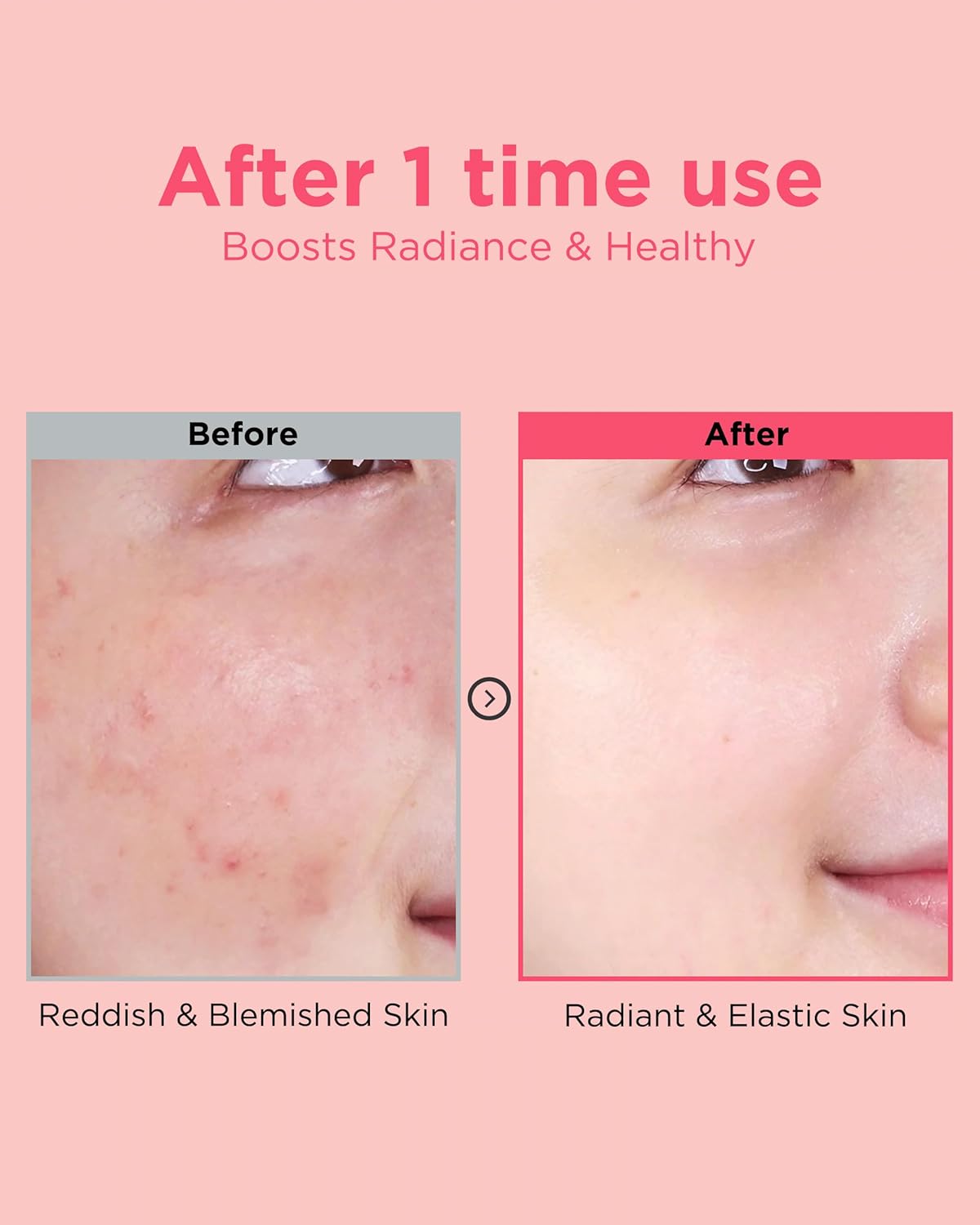 EASYDEW DW-EGF Peptide Re-DERMA Master Ampoule - Korean Anti-Aging Skincare Facial Serum - Firming