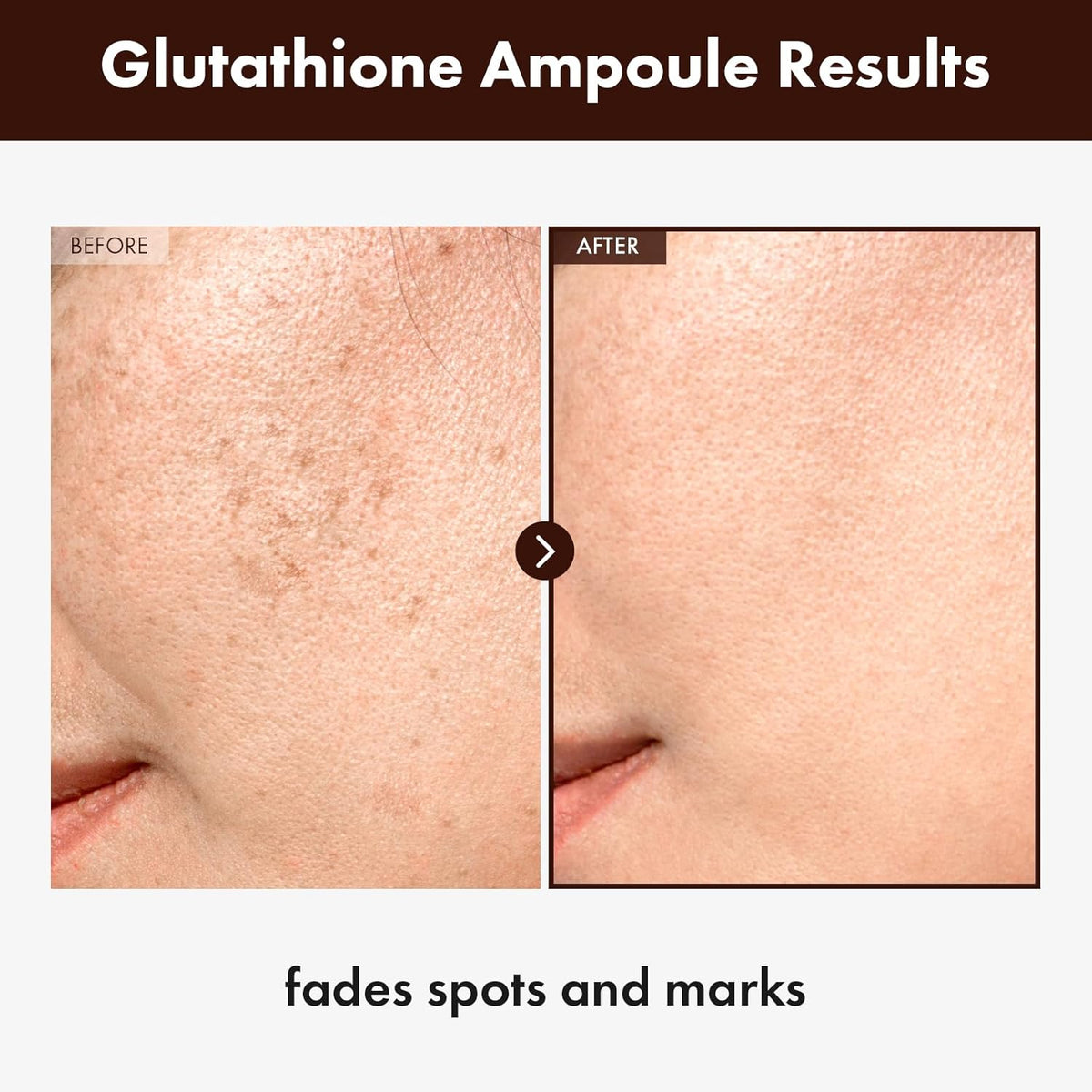 Glutathione Serum with 20,000ppm Glutathione, Niacinamide and hyaluronic acid, Dark Spot, Improve