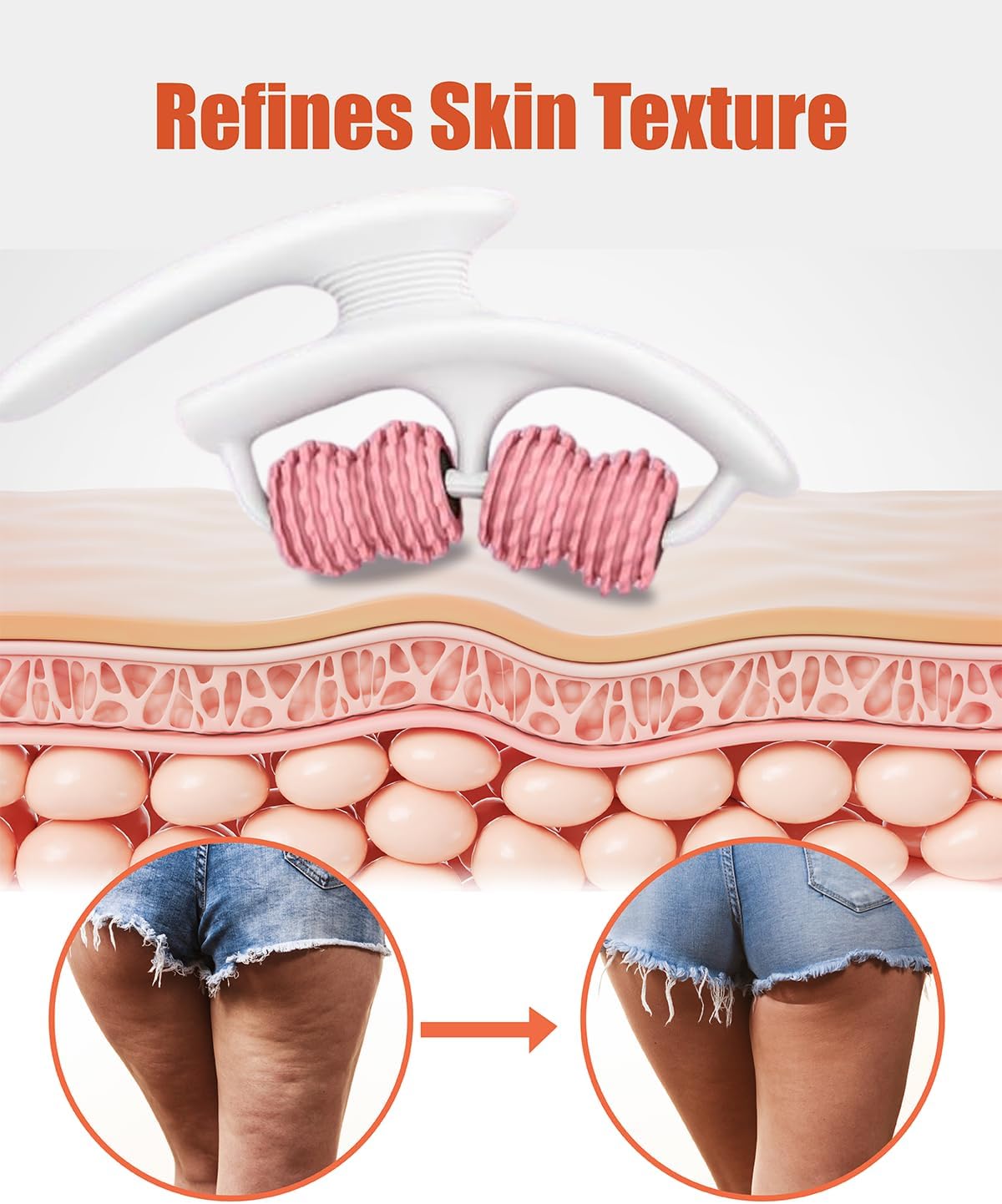 Cellulite Massage Roller - Anti-Cellulite Massager with Detachable Roller Handles for Thighs, Legs