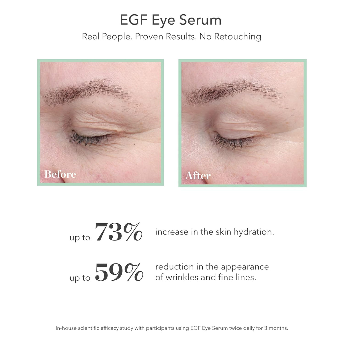 BIOEFFECT EGF Eye Serum Refill Set with Cooling Rollerball (6 ml) and One Refill Cartridge (6ml)
