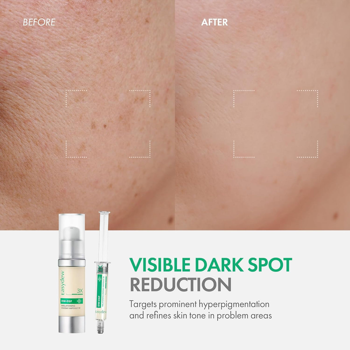Easydew DW-EGF Melatoning Ampoule 3X - Hydrating Dark Spot Serum with Niacinamide & Glutathione for