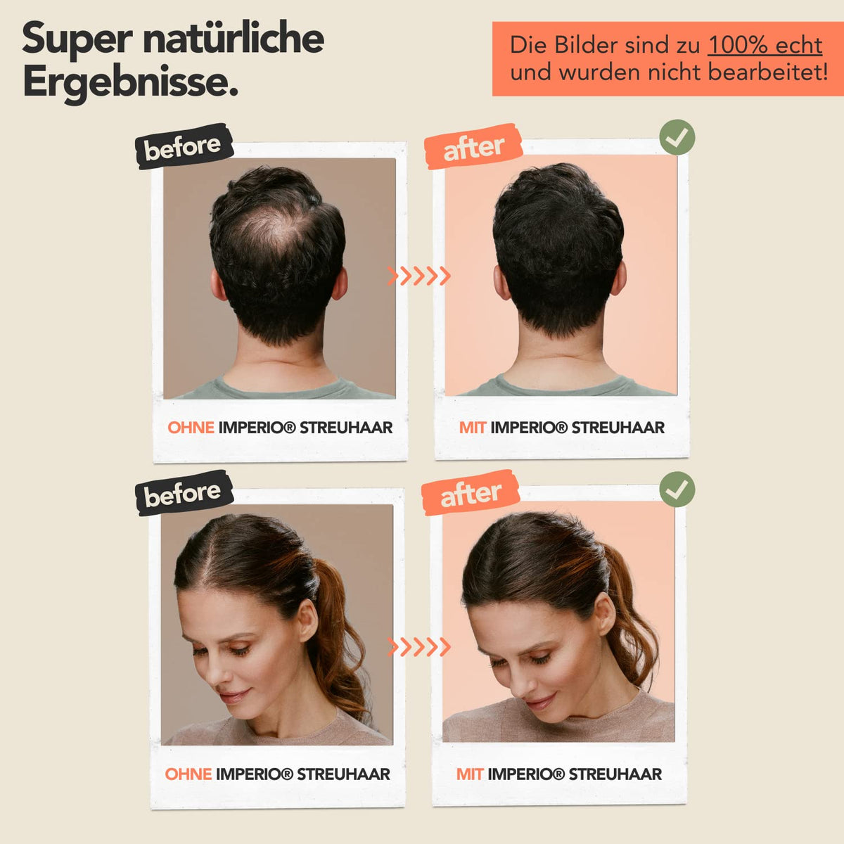 IMPERIO Hair Building Fibers for Thinning Hair - 26g Premium Hair Fibers for Women & Men in