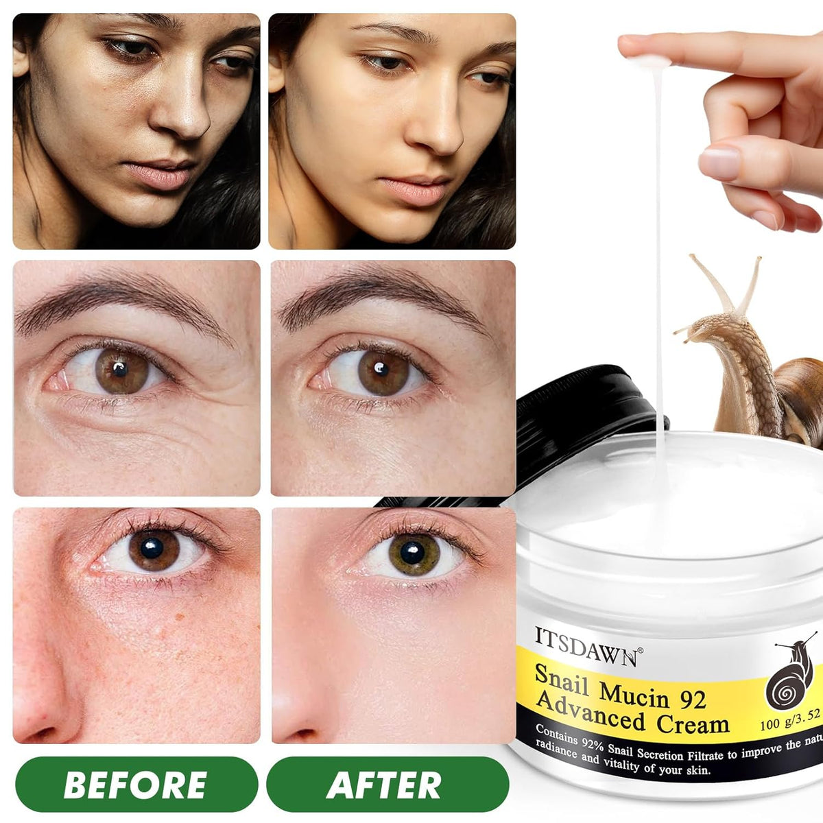 2 Pack Snail Mucin 92% Face Cream 100g, Moisturizer Hydrating Cream for Dry & Sensitive Skin, All