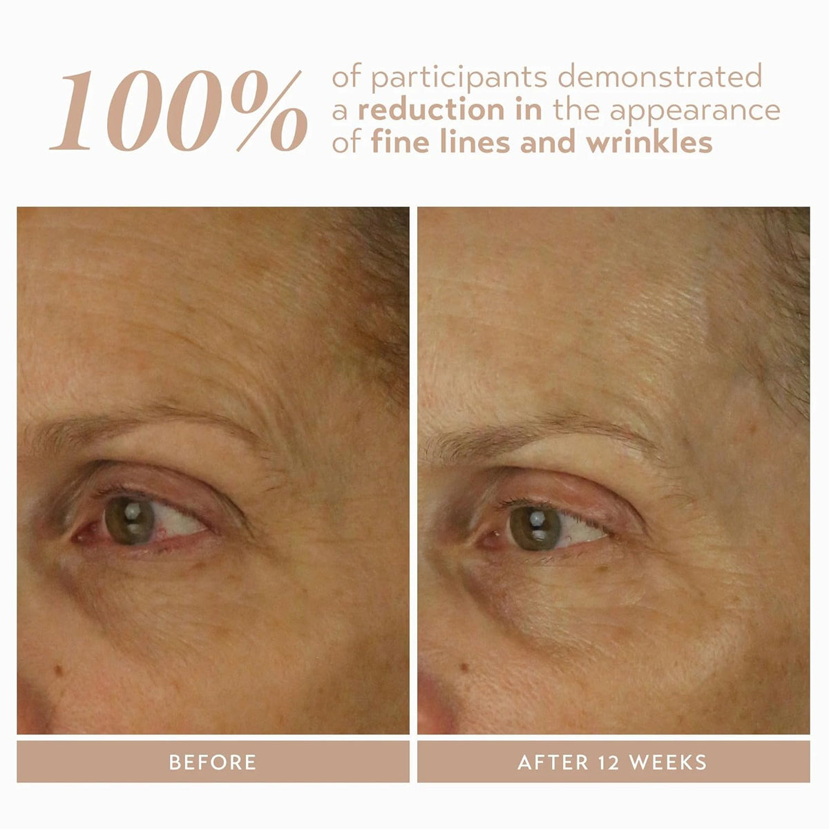 SHANI DARDEN SKIN CARE Retinol Reform with 1% Encapsulated Retinol Serum for Face & Neck, Gentle