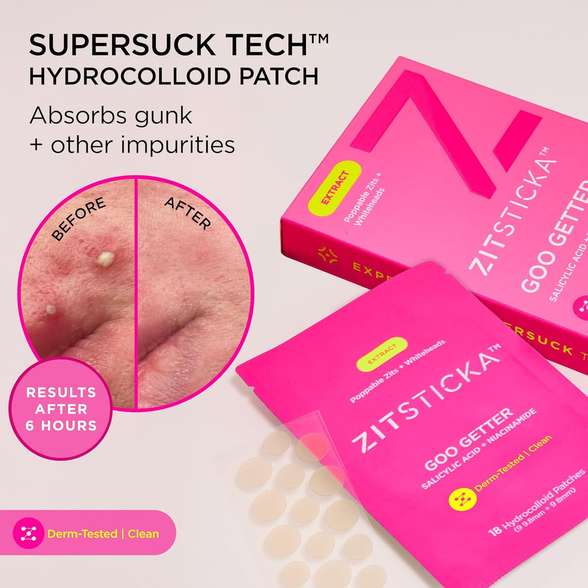 ZitSticka Pimple Patches for Face and Body, Goo Getter Hydrocolloid Patches to Cover Zits &