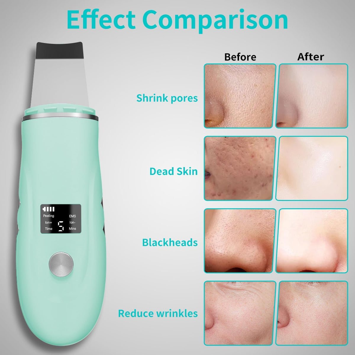 Face Scrubber Skin Spatula - Blackhead Remover Deep Cleansing Tool for Pore Extraction, 4-in-1 Fast