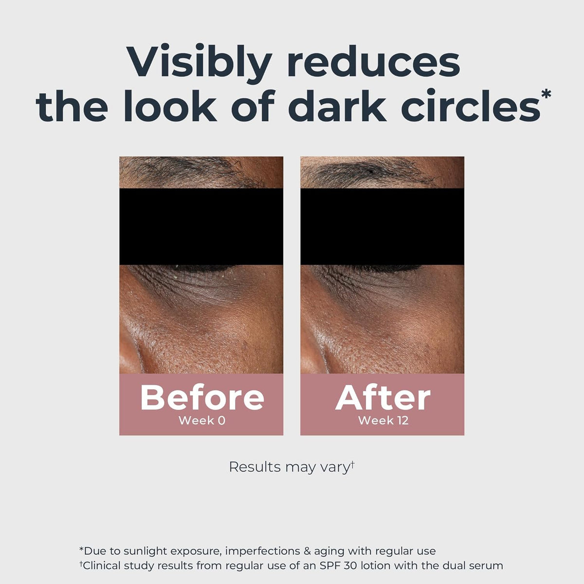 Eucerin Radiant Tone Eye Cream Dark Circle Corrector, Eye Brightening Cream with Thiamidol and