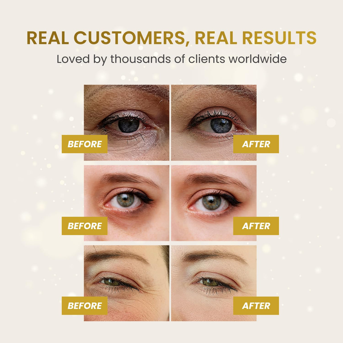 PLANTIFIQUE Gold Eye Patches for Puffy Eyes | 30 Pairs | Gifts | Under Eye Masks for Dark Circles |