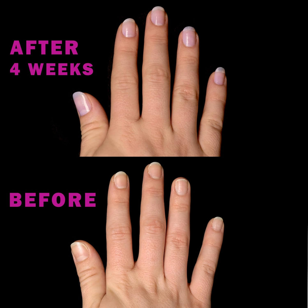 Perfect Formula Pink Gel Coat - Nail Strengthener and Strengthening Polish for Women, Extra Strong