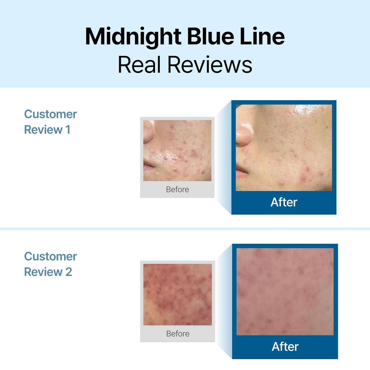 DearKlairs Midnight Blue Calming Cream – Soothing Face Moisturizer for Oily & Sensitive Skin