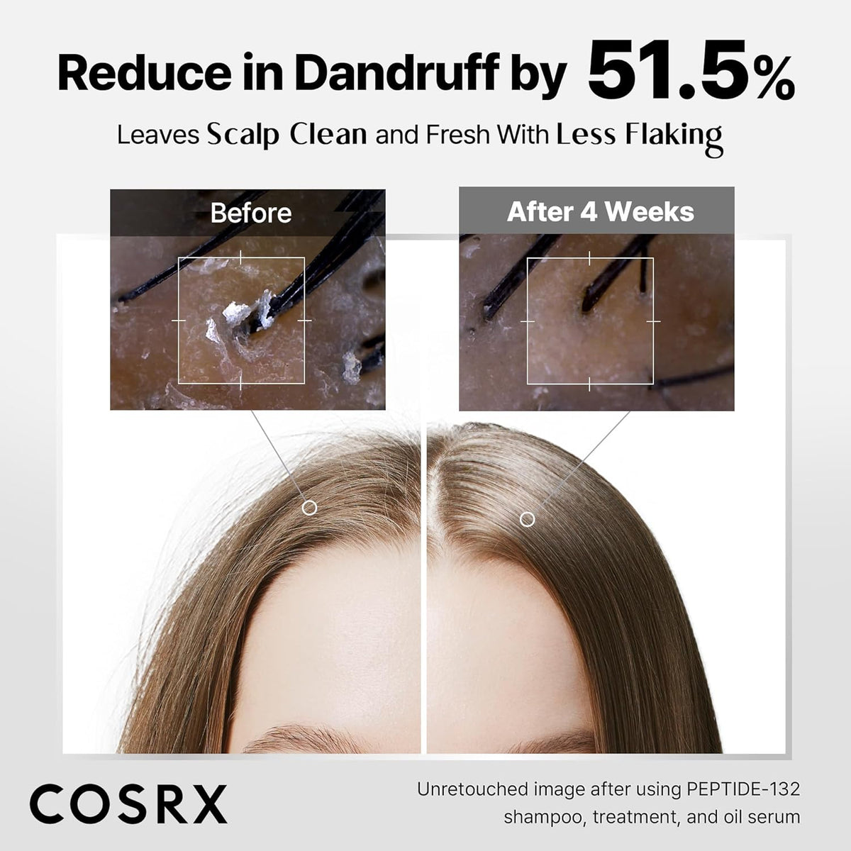 COSRX PEPTIDE 132 Hair Bonding Shampoo - Daily Scalp Treatment for Dandruff, Dry, Itchy or Flaky