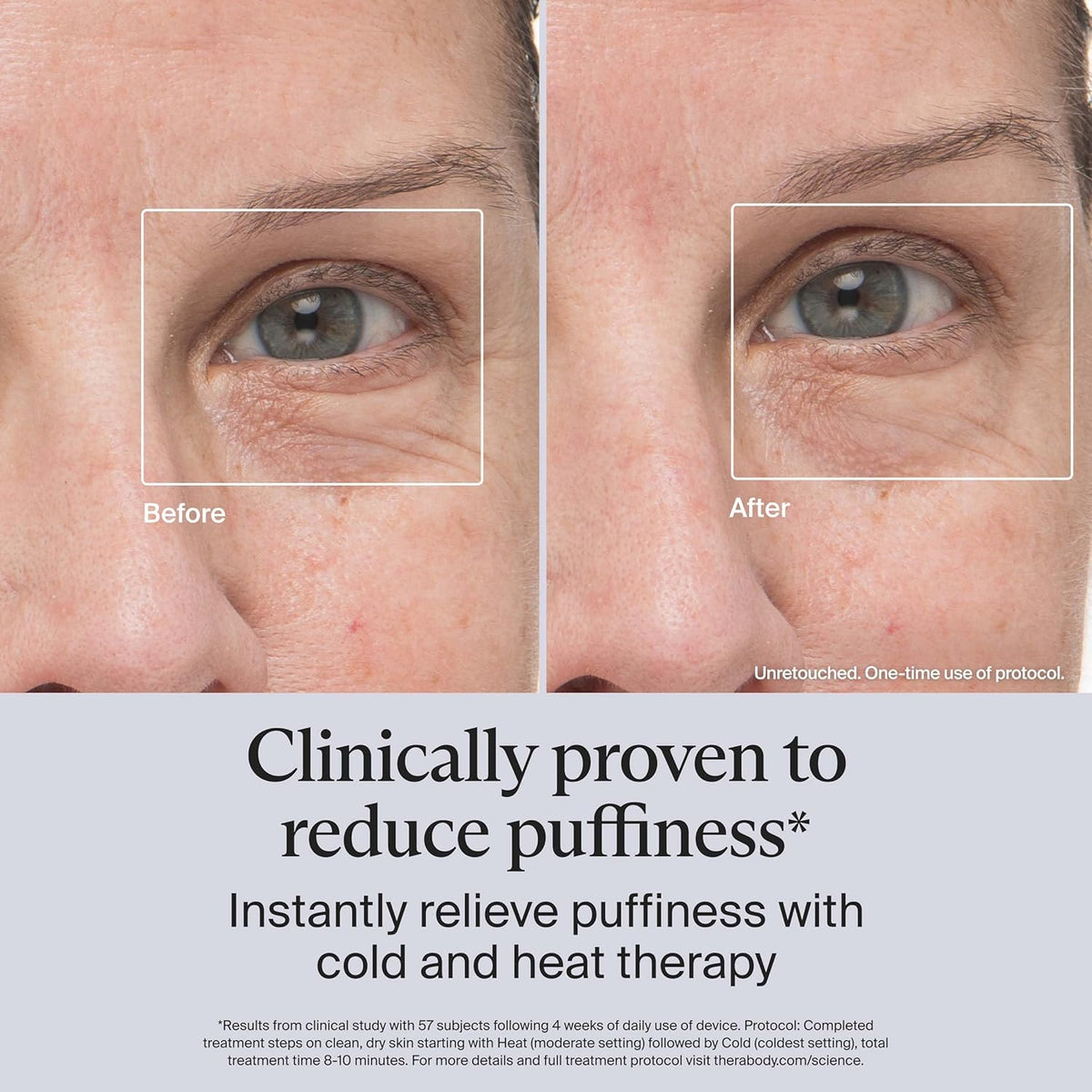 Therabody TheraFace Depuffing Wand – Cold and Heat Skincare Treatment to Depuff and Glow; Beauty