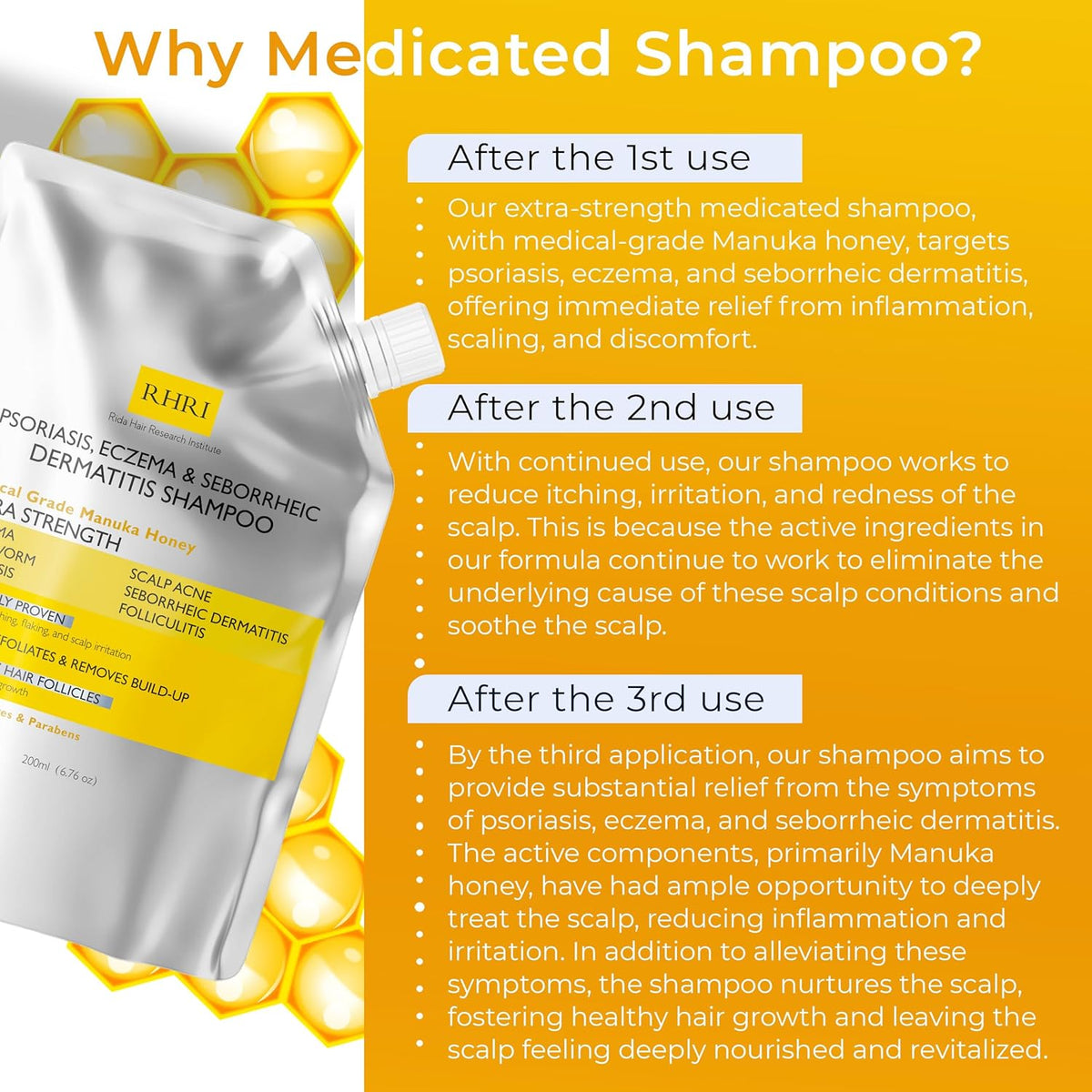 Antifungal Psoriasis Shampoo, Eczema, Seborrheic Dermatitis Shampoo | Soothes Itching, Flaking &