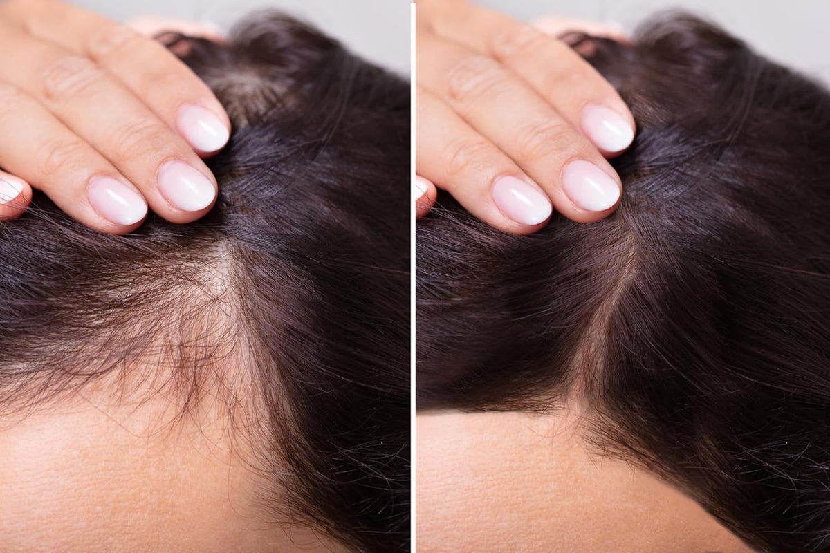 velona Hair Growth Formula - 4 oz | Castor, Amla, Jojoba, Argan, Rosemary, Peppermint, Tea Tree