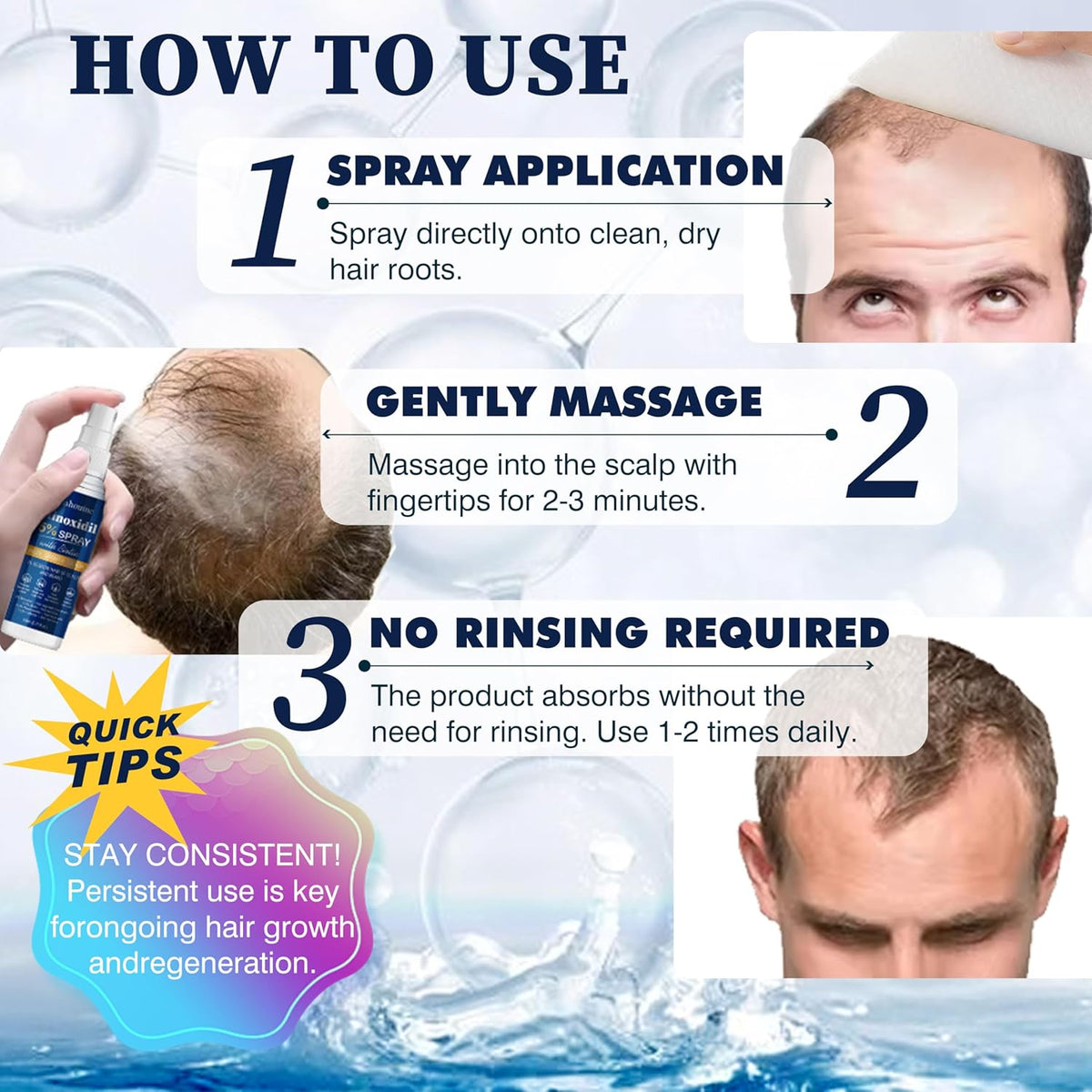 5% Minoxidil Hair Growth Spray Serum, Hair Regrowth Treatment for Men and Women, Strengthens and