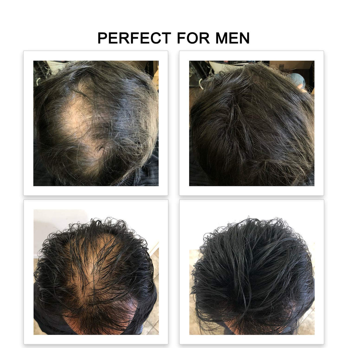 FEBRON Hair Fibers For Thinning Hair LIGHT BROWN Giant 30G For Women & Men Hair Loss Concealer Hair
