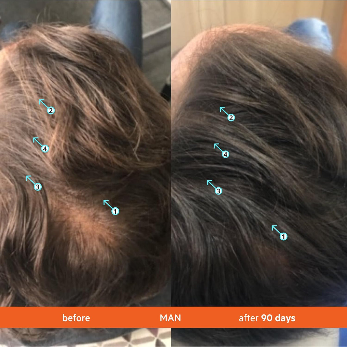DS Labs Revita Shampoo & Spectral Men’s Serum Kit – Scalp First Cleanse & Lightweight Leave-In for