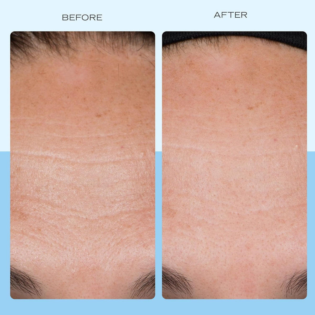 First Aid Beauty Firming Collagen Cream with Collagen, Peptides and Niacinamide – Day + Night