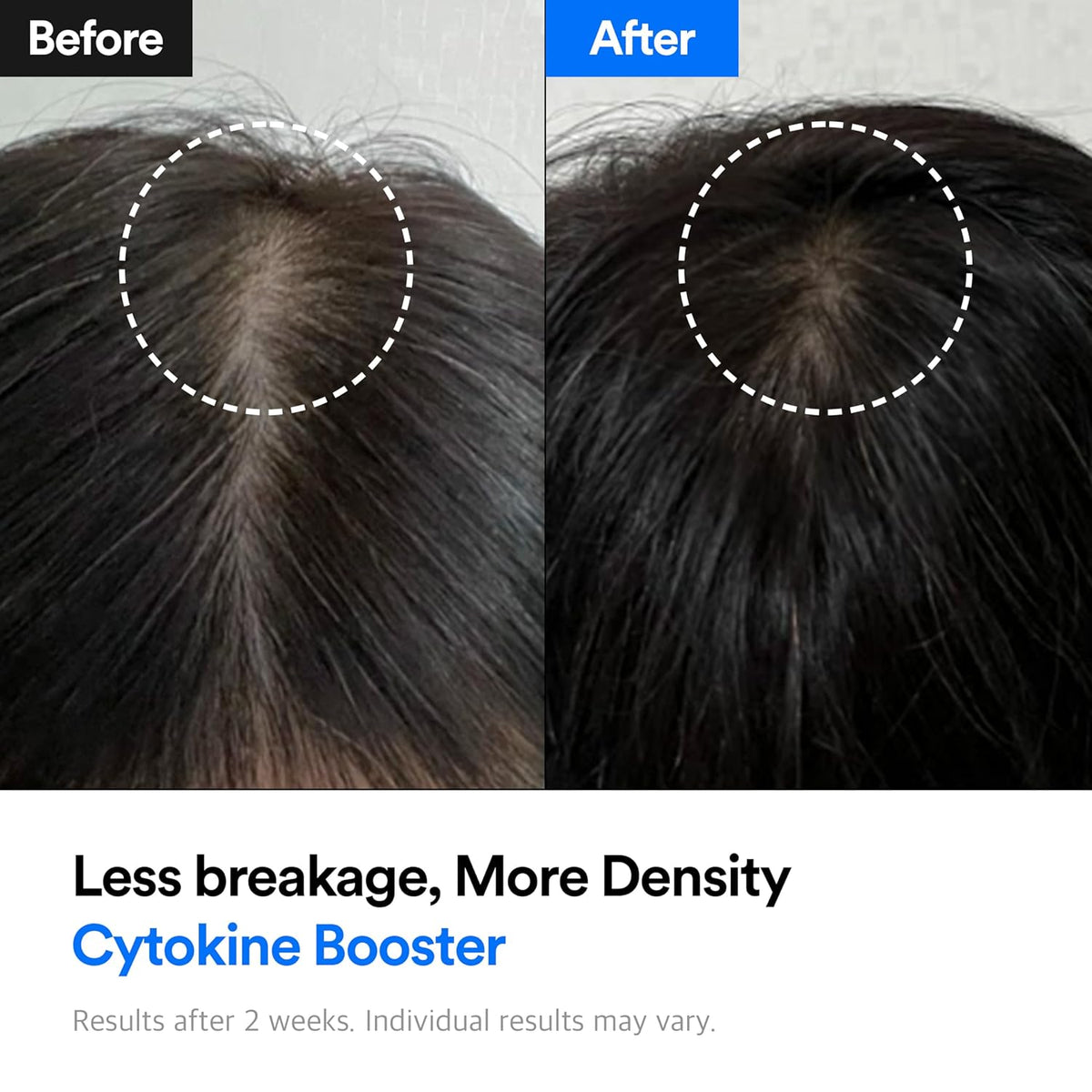Hair-Recovery Cytokine Booster, 3.38 Fl.Oz.– Hair Regrowth Tonic for Thinning Hair, Hair Loss
